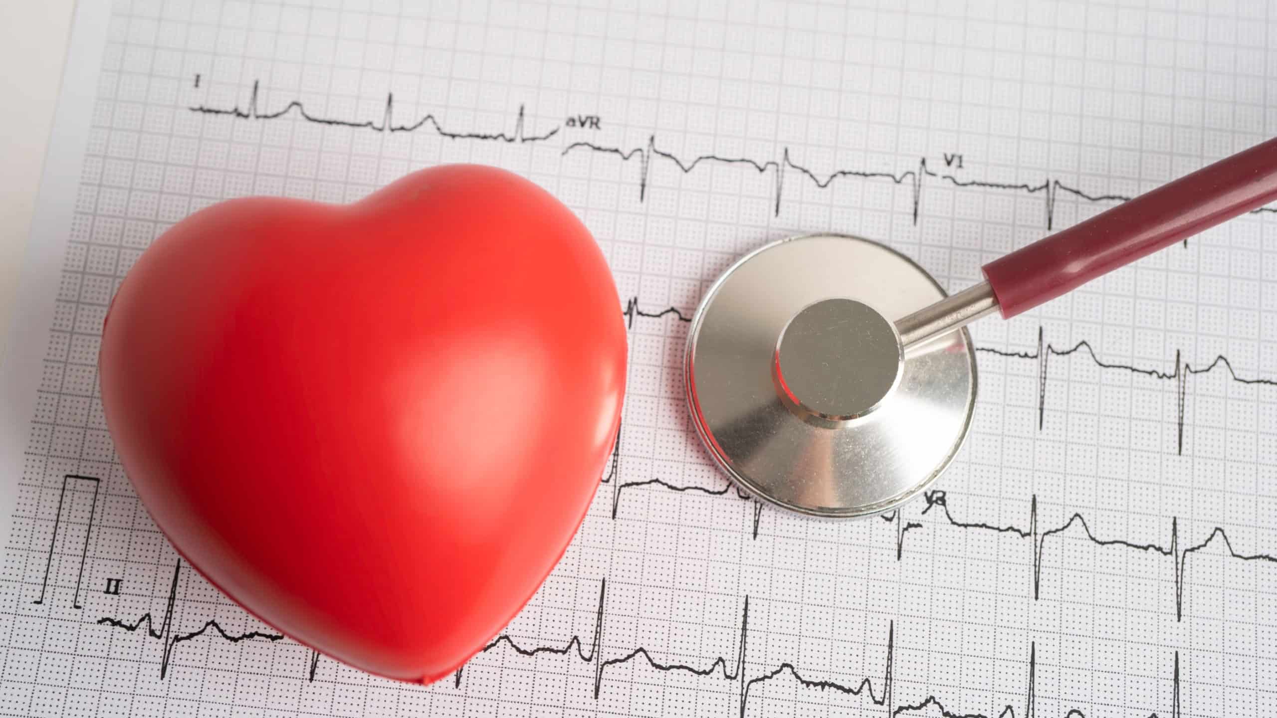 Stethoscope on electrocardiogram ECG, heart wave, heart attack, cardiogram report.